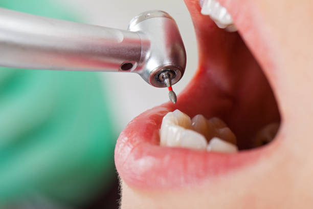 Professional Emergency Dental Service in CA